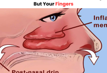 How To Clear Your Sinuses With Nothing But Your Fingers 600 x 503 px