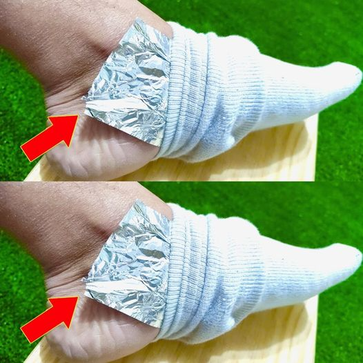 Put Aluminum Foil on Your Feet and Say Goodbye to Aches and Pains1