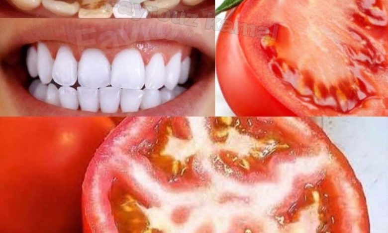 teeth tomato