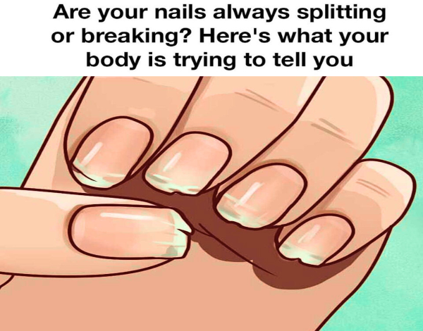 Are Your Nails Always Splitting Or Breaking Heres What Your Body Is Trying To Tell You