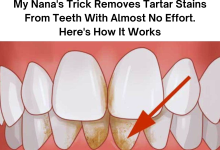 My Nanas Trick Removes Tartar Stains From Teeth With Almost No Effort Heres How It Works e1727075767180