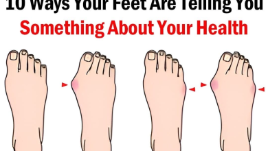 10 Ways Your Feet Are Telling You Something About Your Health333 e1730176008282