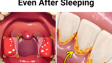 6 Effective Ways To Avoid Bad Breath Even After Sleeping