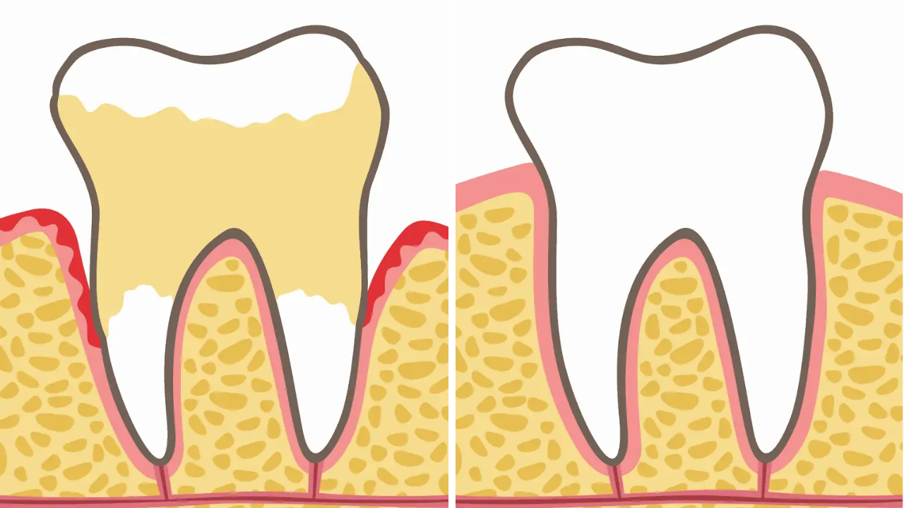 Dentists Explain 7 Habits That Can Harm Your Teeth and Gums