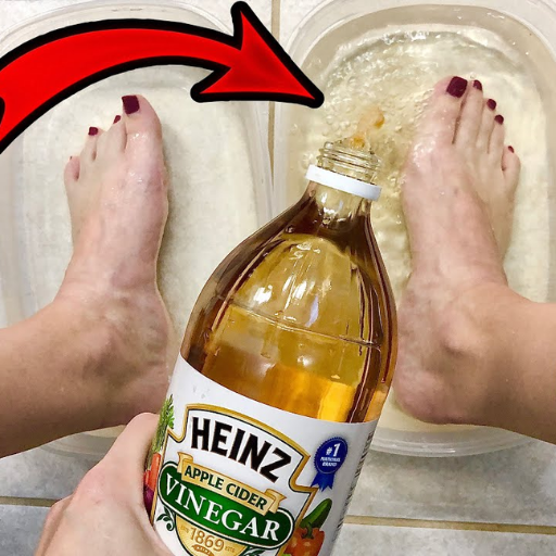 Unlocking the Secrets How Soaking Your Feet in Apple Cider Vinegar Aids Weight Loss dh1c98s9d 270tds6w