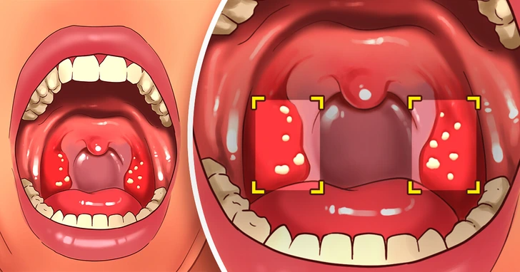 6 Effective Ways to Keep Your Breath Fresh Even After a Long Sleep 1