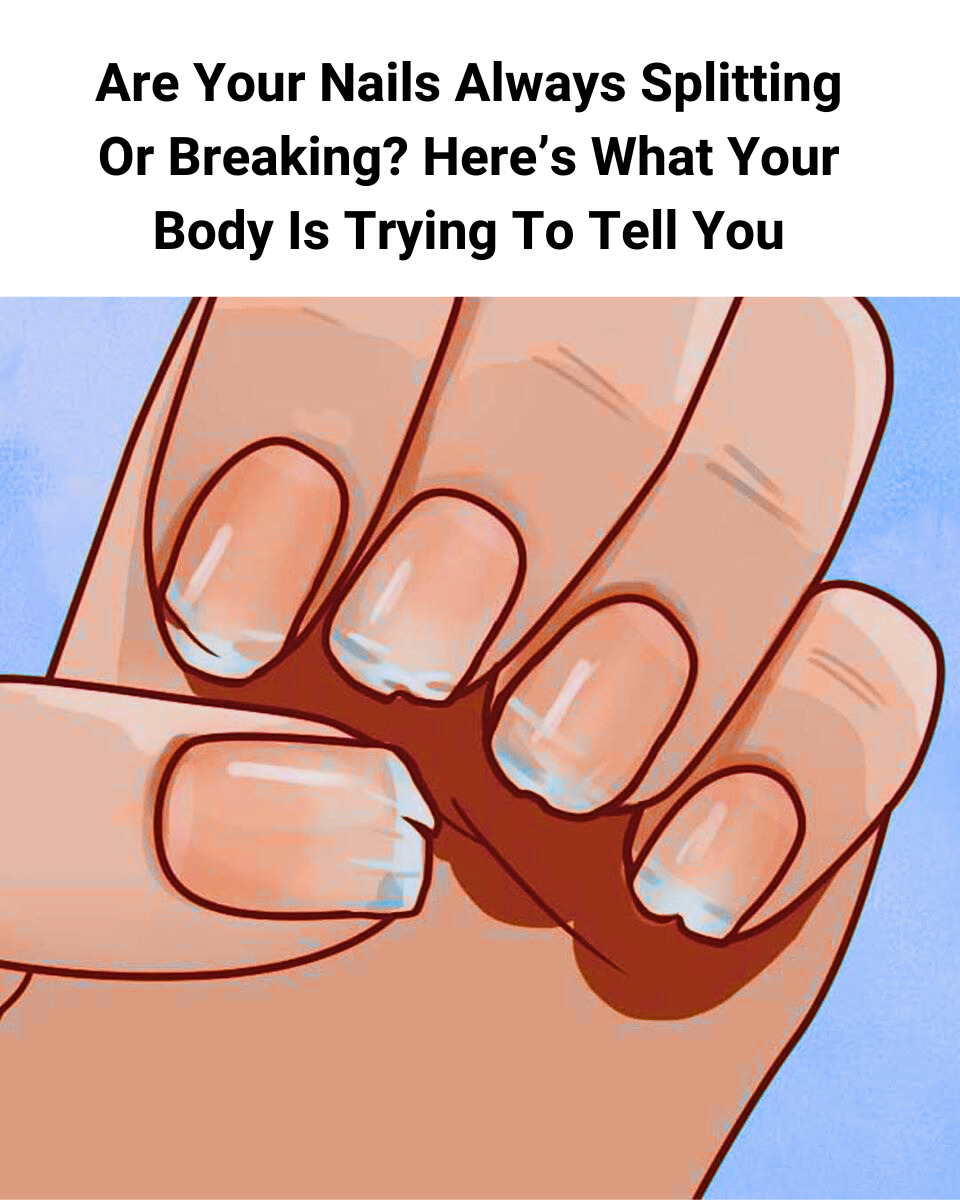 Are Your Nails Always Splitting Or Breaking Heres What Your Body Is Trying To Tell You3 1