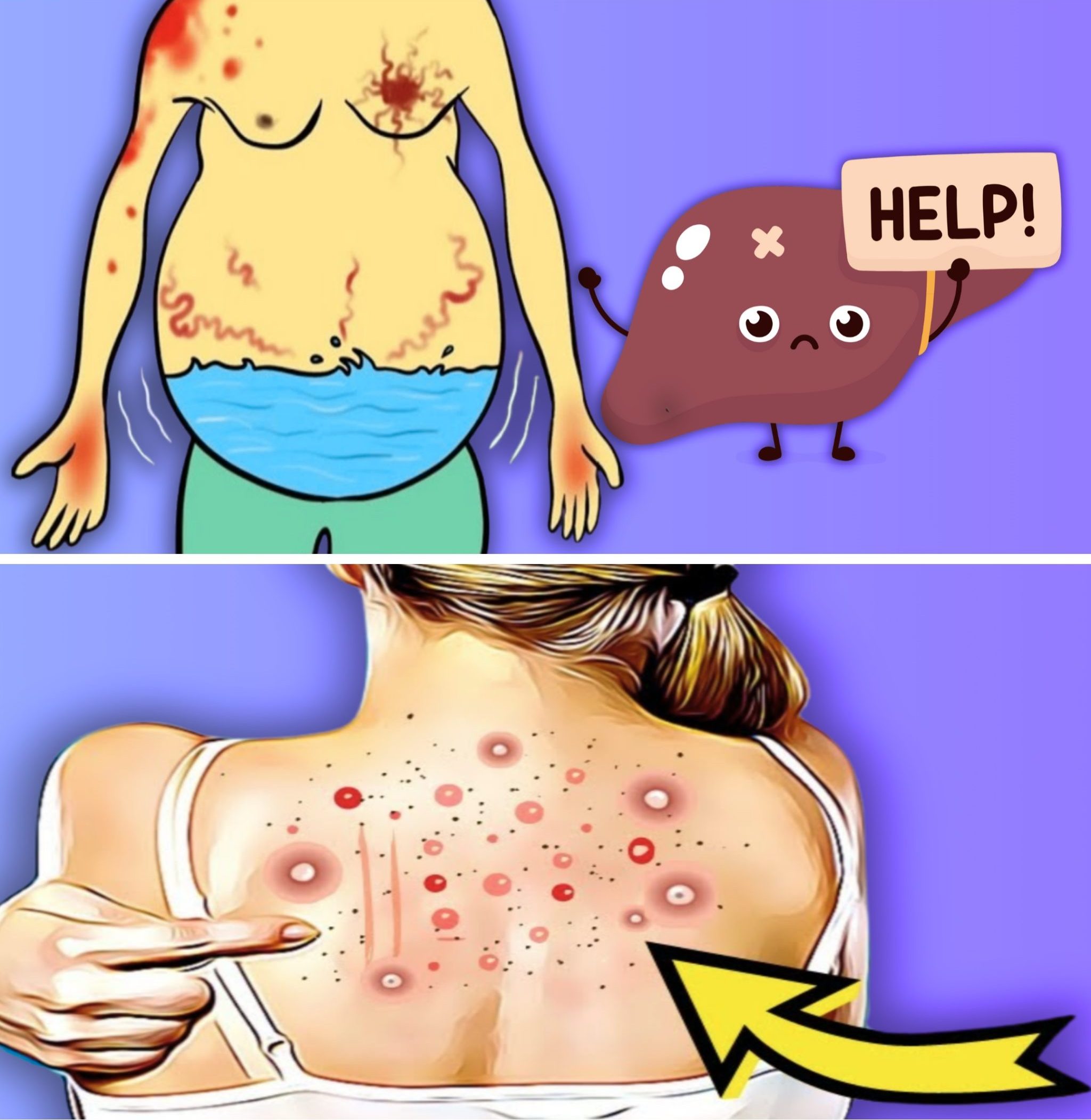 Early Signs of Fatty Liver Disease You Must Never Ignore 4 4531 scaled e1748092828713