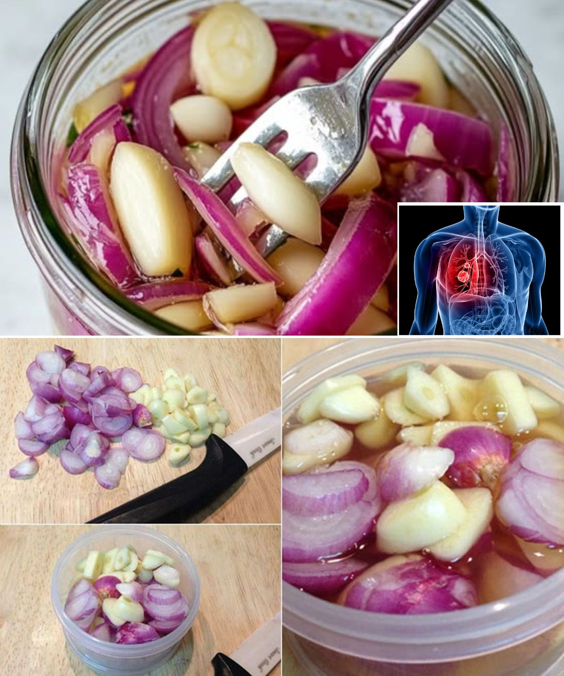 The Ultimate Natural Remedy: Red Onion, Garlic, and Honey for Coughs, Colds, and Lung Health 2 755 1