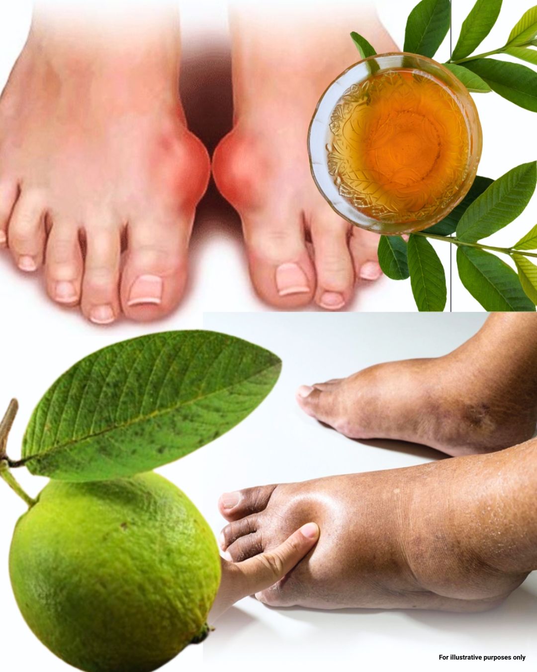 Guava Leaves for Water Retention: A Natural Remedy That Actually Works 2 Guava Leaves
