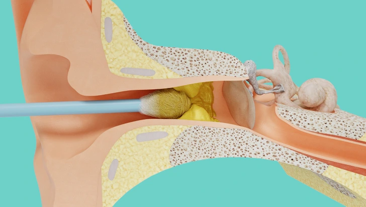 How to Keep Your Ears Clean For Longer 2 download 14
