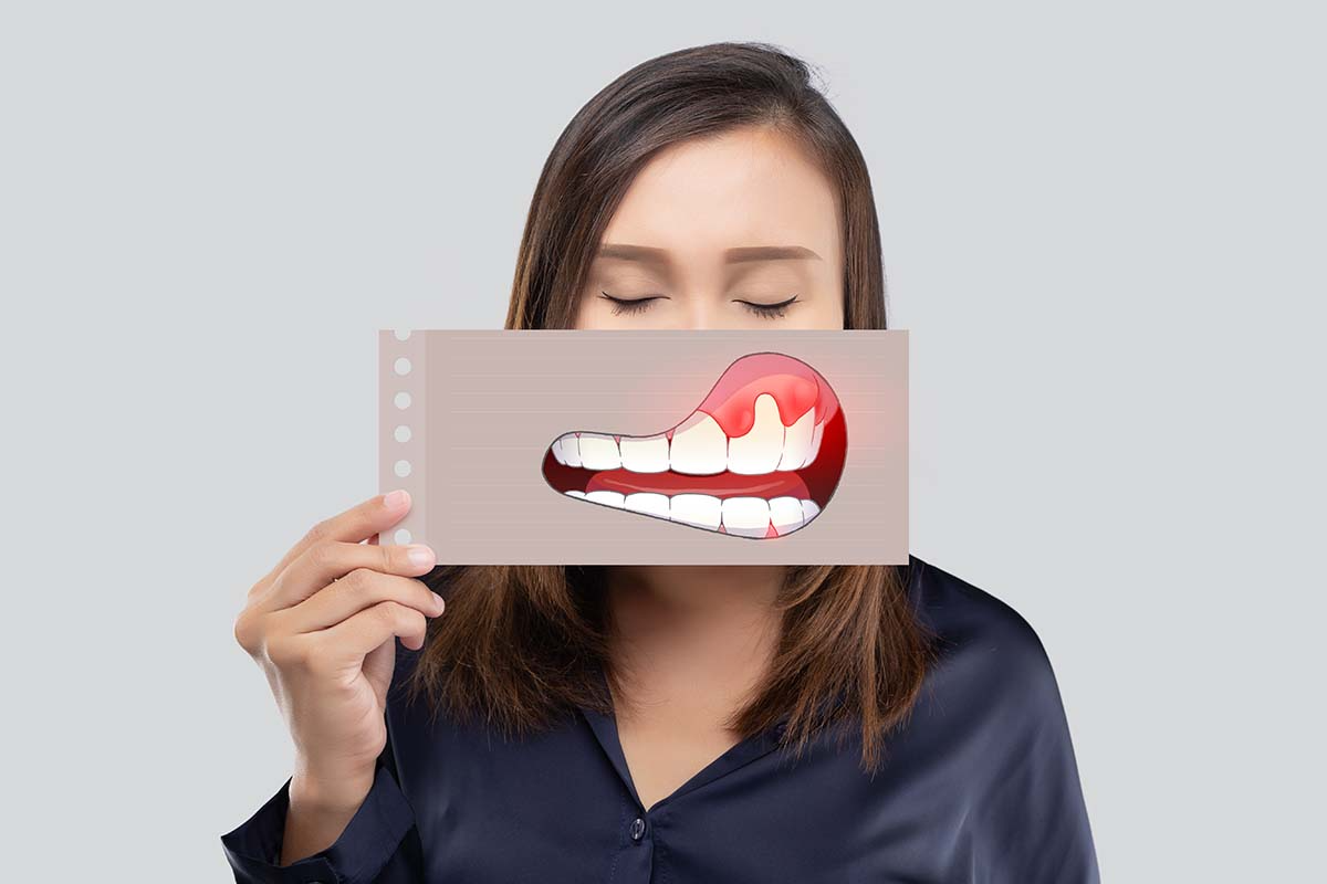 Early Signs of Oral Can-cer You Should Not Ignore 5 download 20