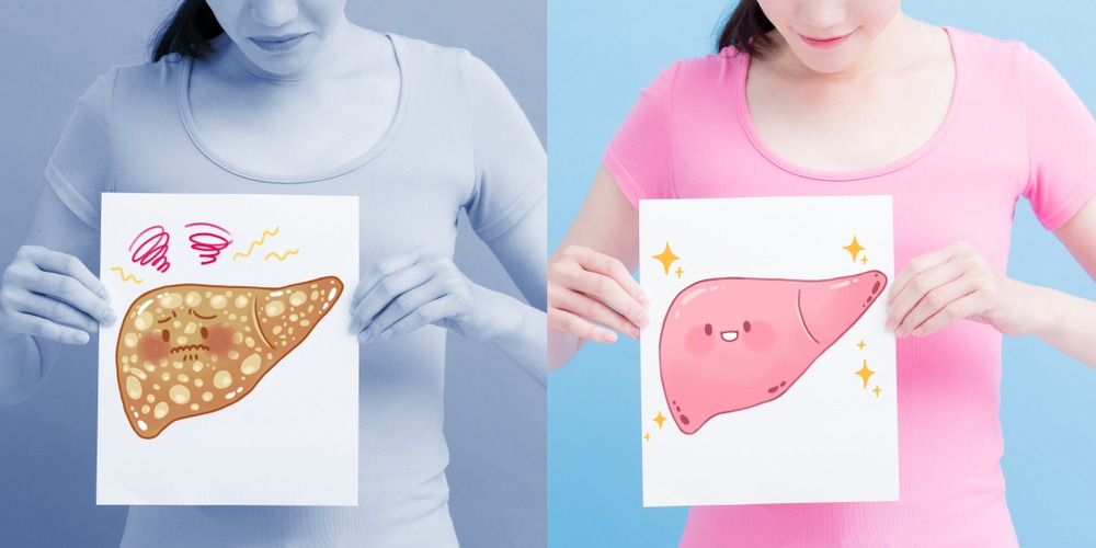 Early Signs of Fatty Liver Disease You Must Never Ignore 2 download 3 10