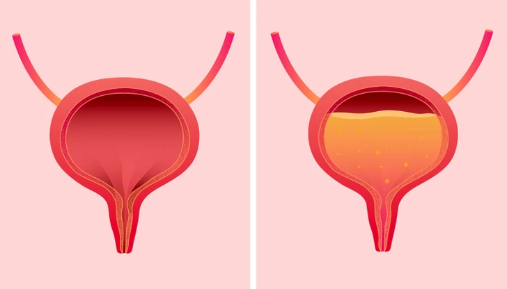 10+ Early Menopause Indicators You Should Not Ignore 2 download 33