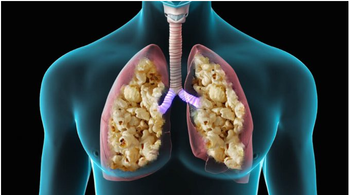 Health experts issue urgent warning over 'popcorn lung' 2 download 4