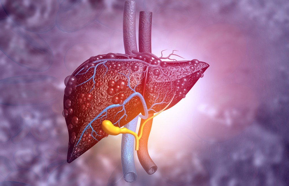 Early Signs of Fatty Liver Disease You Must Never Ignore 3 download 44