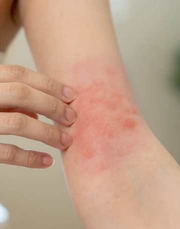 10+ Alarming Signs Your Body Needs Help 5 ggg e1746990541582