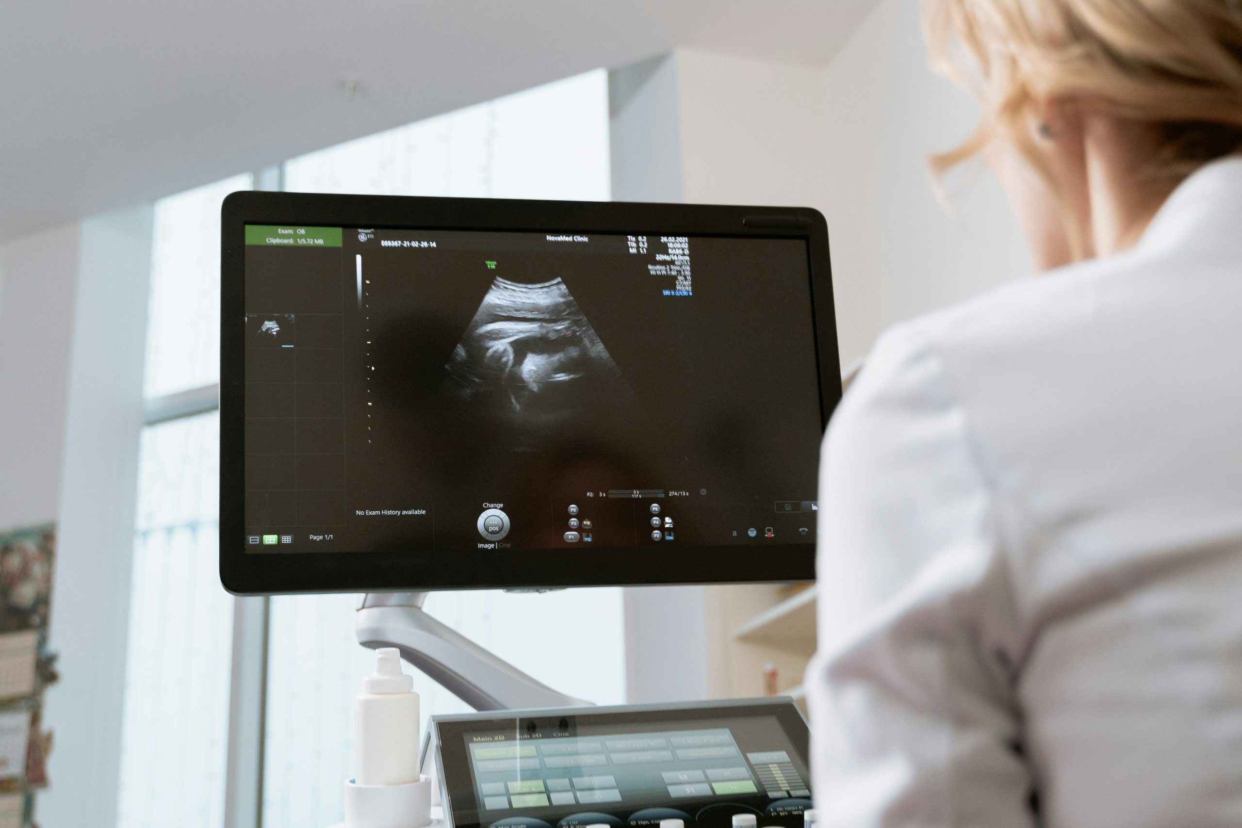 53-Year-Old Woman Gave Birth To Twins, But They Had The Same Birthmarks As Her Son-In-Law 1 pexels mart production 7088485 scaled