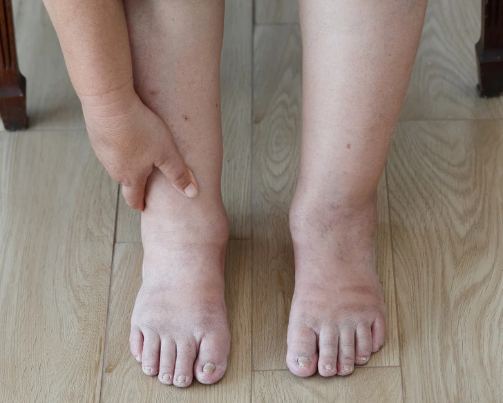 10+ Alarming Signs Your Body Needs Help 6 signs 3