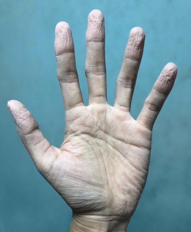 10+ Alarming Signs Your Body Needs Help 2 signs 9