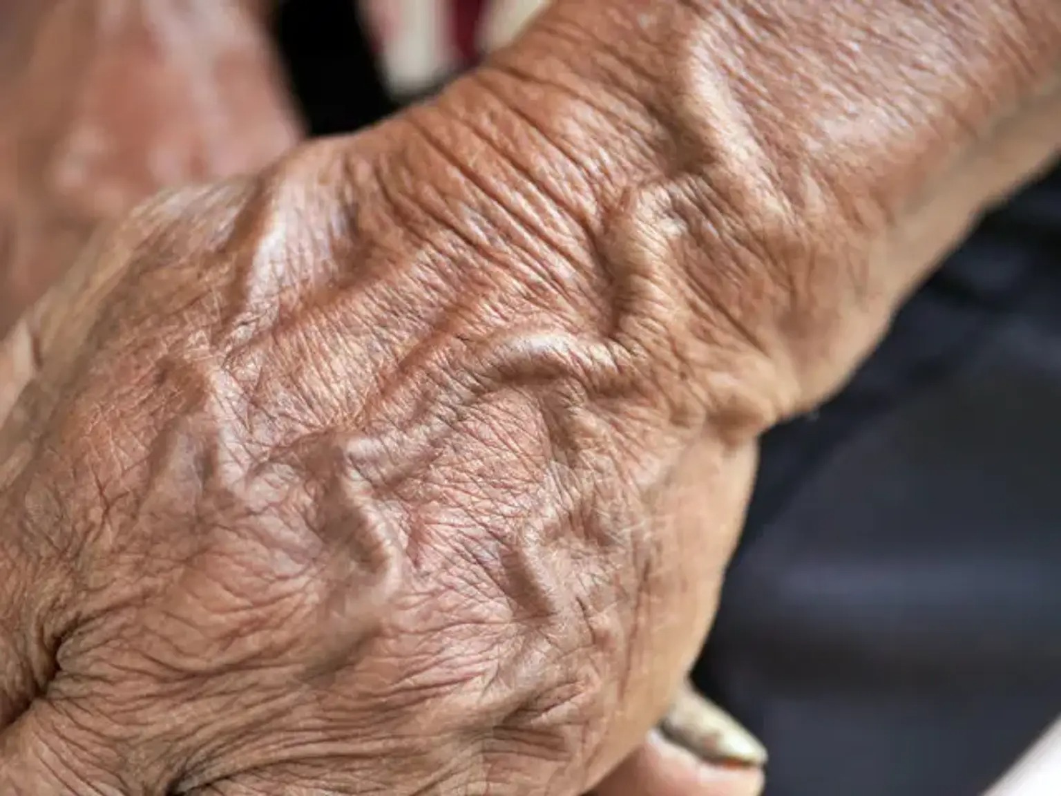 Aging of veins 5dcbfeec 1575 4fd